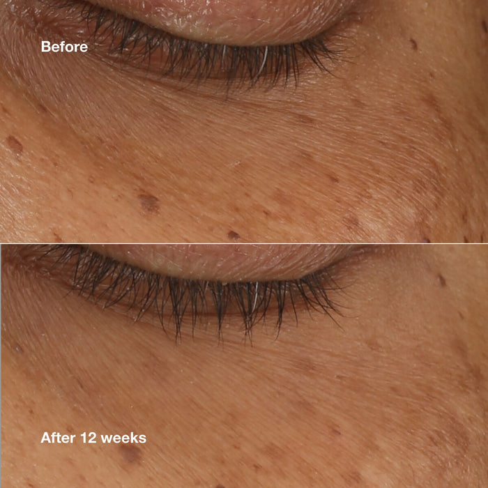 Serum Iluminator Clinique ALL ABOUT EYES 10 ml - WALTI WALTI