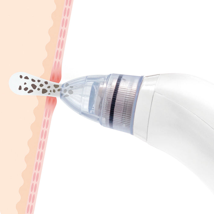 Aparat electric facial de curățare a punctelor negre Pore·Off InnovaGoods - WALTI WALTI