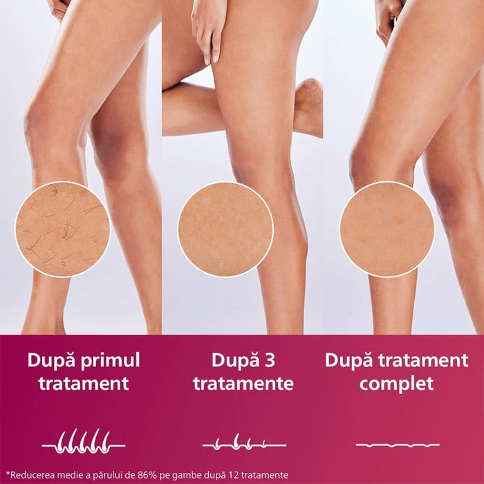 Epilator IPL PHILIPS Lumea Prestige Seria 8000 BRI947/00, 450.000 de impulsuri, 4 accesorii, senzor SmartSkin, retea, argintiu WALTI