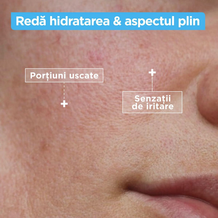 Mixa Gel de curățare anti-uscăciune, 150 ml WALTI