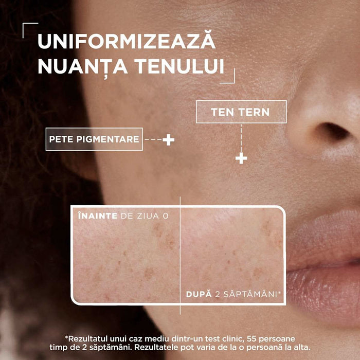 Mixa Serum anti pete pigmentare pentru tenul sensibil, 30 ml WALTI